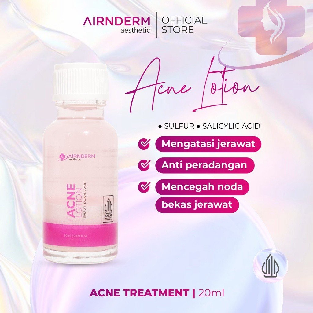 Acne Lotion