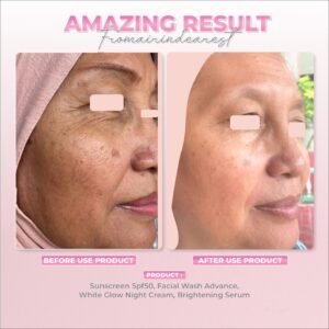 Alternative view of Brightening Serum (Vitamin C 15%)