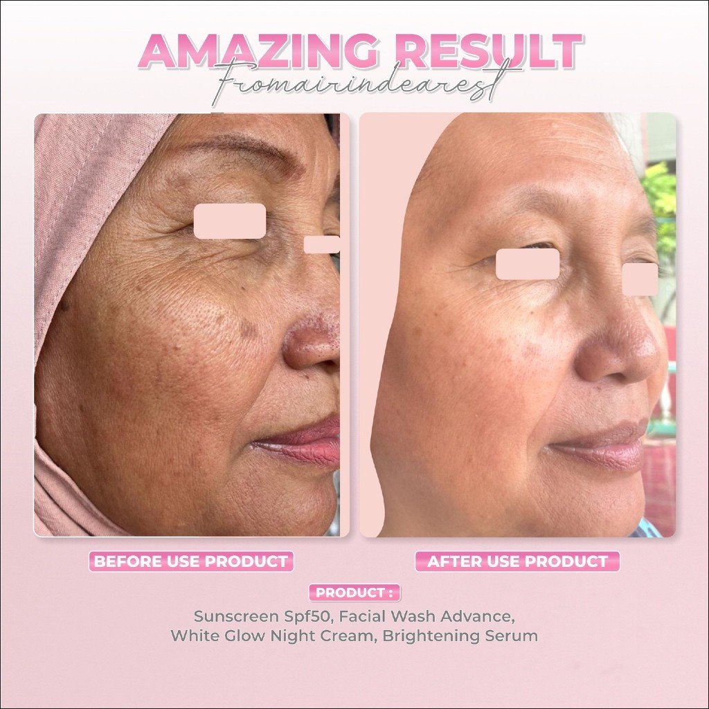 Alternative view of Brightening Serum (Vitamin C 15%)