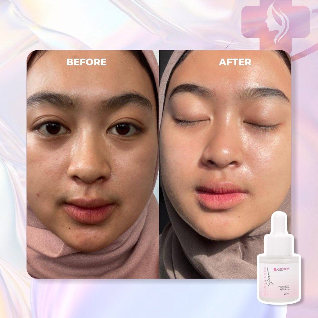 Alternative view of Glass Skin Serum