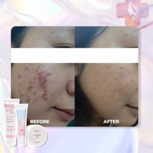 Alternative view of Niacinamide Gel 50gr