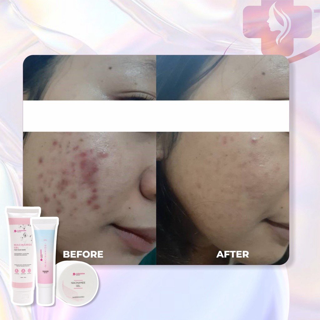 Alternative view of Niacinamide Gel 50gr