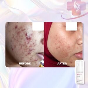 Alternative view of Radiant Serum