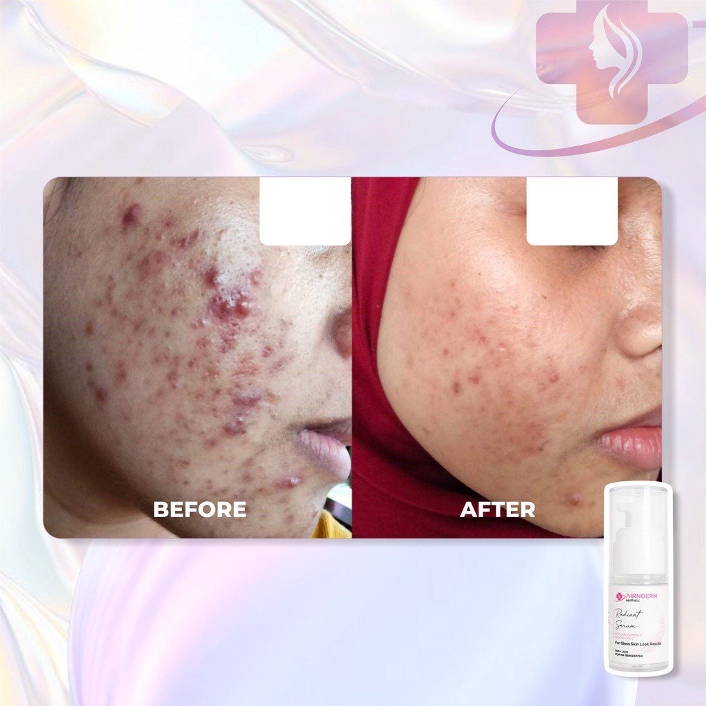 Alternative view of Radiant Serum