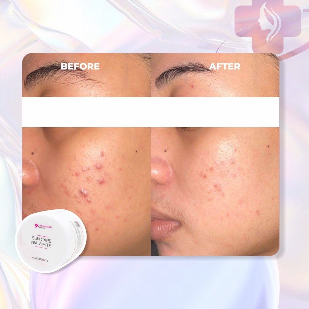 Alternative view of Suncare Nia White 20gr