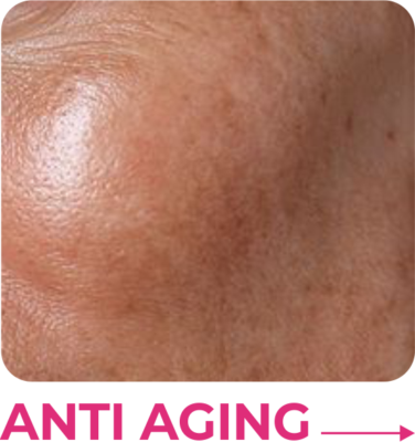 ⋆ ANTI AGING ⋆