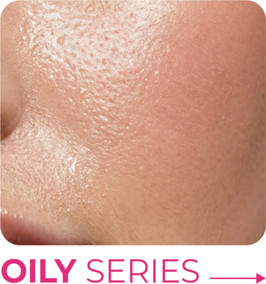 ⋆ OILY SERIES ⋆